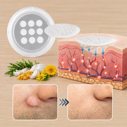 ✨✨✨ PURESHADE® 2v1 mikrojehličková + hydrokoloidní náplast🍀 | Pomáhá odstraňovat vystouplá znaménka, akné, ploché bradavice a kožní výrůstky | Pomáhá zjemnit vrásky, jizvy a nedokonalosti pleti | Diskrétní neviditelná náplast pro obličej i tělo