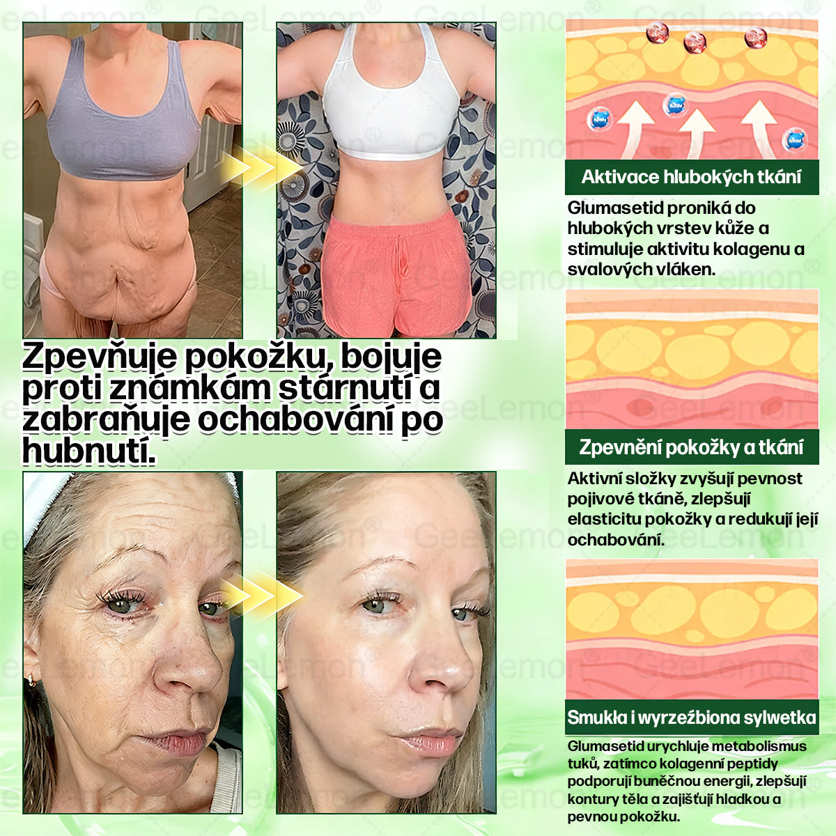 Doporučeno Fakultní nemocnicí Motol · 👩‍⚕️ Oficiální prodejna BENU | 🎁 𝐆𝐞𝑒𝑙𝑒𝐦𝐨𝐧® Glum𝐚𝐬𝐞tide 8 v 1 – Zeštíhlující nano mikrojihlový náplast 🇨🇿 Jen 1× denně ✅ Viditelné změny za 7 dní – na obezitu, kardiovaskulární zdraví, diabetes a kloubní problémy