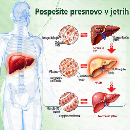 Registrirano pri JAZMP in GMP certificirano👩‍⚕️🎁 𝐆𝐞𝑒𝐿𝑒𝐦𝐨𝐧® 𝐆𝐥𝐮𝐦𝐚𝐬𝐞𝐭𝐢𝐝𝐞 8 v 1 Hujševalni in zdravju namenjen nano obliž z mikroiglicami 🇸🇮 (Samo enkrat na dan, vidne spremembe že v 7 dneh)