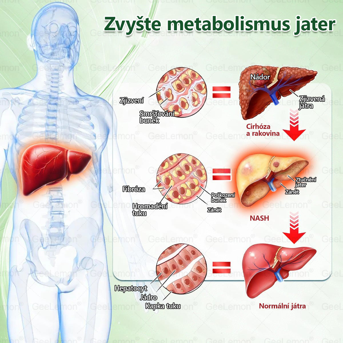 Doporučeno Fakultní nemocnicí Motol · 👩‍⚕️ Oficiální prodejna BENU | 🎁 𝐆𝐞𝑒𝑙𝑒𝐦𝐨𝐧® Glum𝐚𝐬𝐞tide 8 v 1 – Zeštíhlující nano mikrojihlový náplast 🇨🇿 Jen 1× denně ✅ Viditelné změny za 7 dní – na obezitu, kardiovaskulární zdraví, diabetes a kloubní problémy