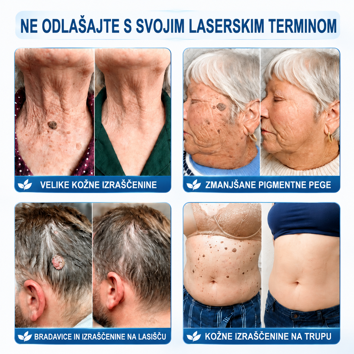 TA PONUDBA NE BO ČAKALA ⏳ ZDAJ −50 % POPUST 🔥 ZALOGE KOPNIJO, ODŠTEVANJE TEČE – KDOR OKLEVA, BO KASNEJE PLAČAL VEČ. UKREPAJ ZDAJ!