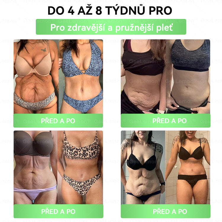 Doporučeno Fakultní nemocnicí Motol · 👩‍⚕️ Oficiální prodejna BENU | 🎁 𝐆𝐞𝑒𝑙𝑒𝐦𝐨𝐧® Glum𝐚𝐬𝐞tide 8 v 1 – Zeštíhlující nano mikrojihlový náplast 🇨🇿 Jen 1× denně ✅ Viditelné změny za 7 dní – na obezitu, kardiovaskulární zdraví, diabetes a kloubní problémy