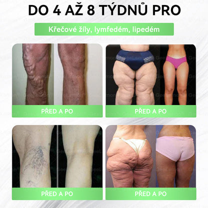 Doporučeno Fakultní nemocnicí Motol · 👩‍⚕️ Oficiální prodejna BENU | 🎁 𝐆𝐞𝑒𝑙𝑒𝐦𝐨𝐧® Glum𝐚𝐬𝐞tide 8 v 1 – Zeštíhlující nano mikrojihlový náplast 🇨🇿 Jen 1× denně ✅ Viditelné změny za 7 dní – na obezitu, kardiovaskulární zdraví, diabetes a kloubní problémy