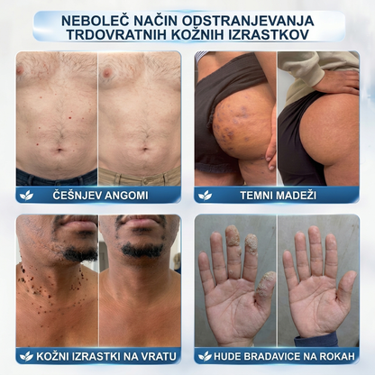 TA PONUDBA NE BO ČAKALA ⏳ ZDAJ −50 % POPUST 🔥 ZALOGE KOPNIJO, ODŠTEVANJE TEČE – KDOR OKLEVA, BO KASNEJE PLAČAL VEČ. UKREPAJ ZDAJ!
