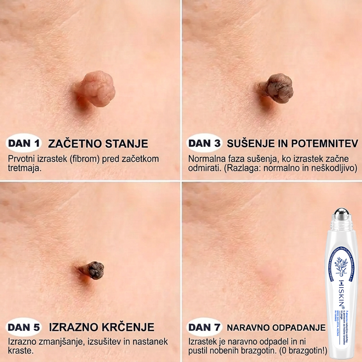 TA PONUDBA NE BO ČAKALA ⏳ ZDAJ −50 % POPUST 🔥 ZALOGE KOPNIJO, ODŠTEVANJE TEČE – KDOR OKLEVA, BO KASNEJE PLAČAL VEČ. UKREPAJ ZDAJ!