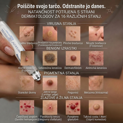 TA PONUDBA NE BO ČAKALA ⏳ ZDAJ −50 % POPUST 🔥 ZALOGE KOPNIJO, ODŠTEVANJE TEČE – KDOR OKLEVA, BO KASNEJE PLAČAL VEČ. UKREPAJ ZDAJ!