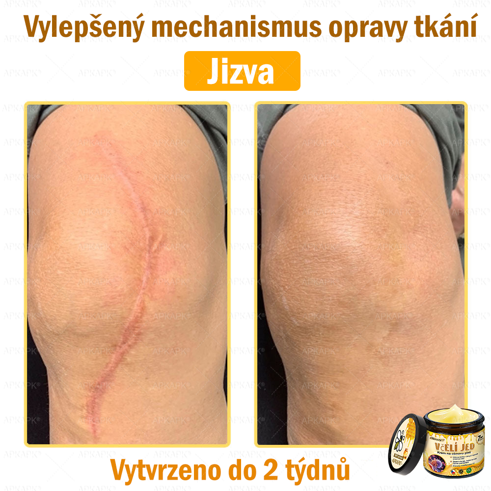 Dermatologicky a klinicky testováno👩‍⚕️APKAPK®Bee Venom Krém na obnovení pleti🐝 pomáhá při léčbě kožních problémů, jako jsou: vrásky, jizvy, pigmentové skvrny, strie, akné, psoriáza, ekzém, kožní změny, podráždění, záněty a další kožní problémy.